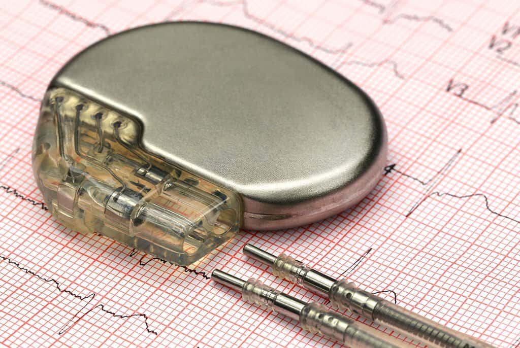 Close up of a pacemake on Electrocardiograph